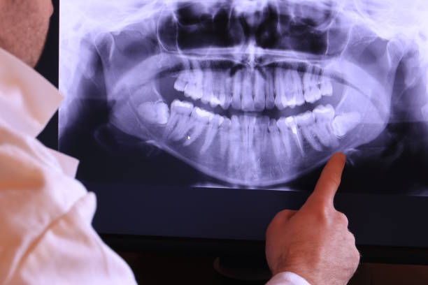 Best Emergency Treatment for Toothache in Loch Lomond, VA