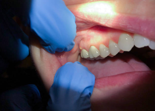 Best Emergency Orthodontic Repairs in Loch Lomond, VA