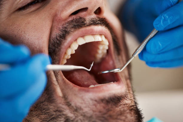 Best Same-Day Emergency Dentist in Loch Lomond, VA